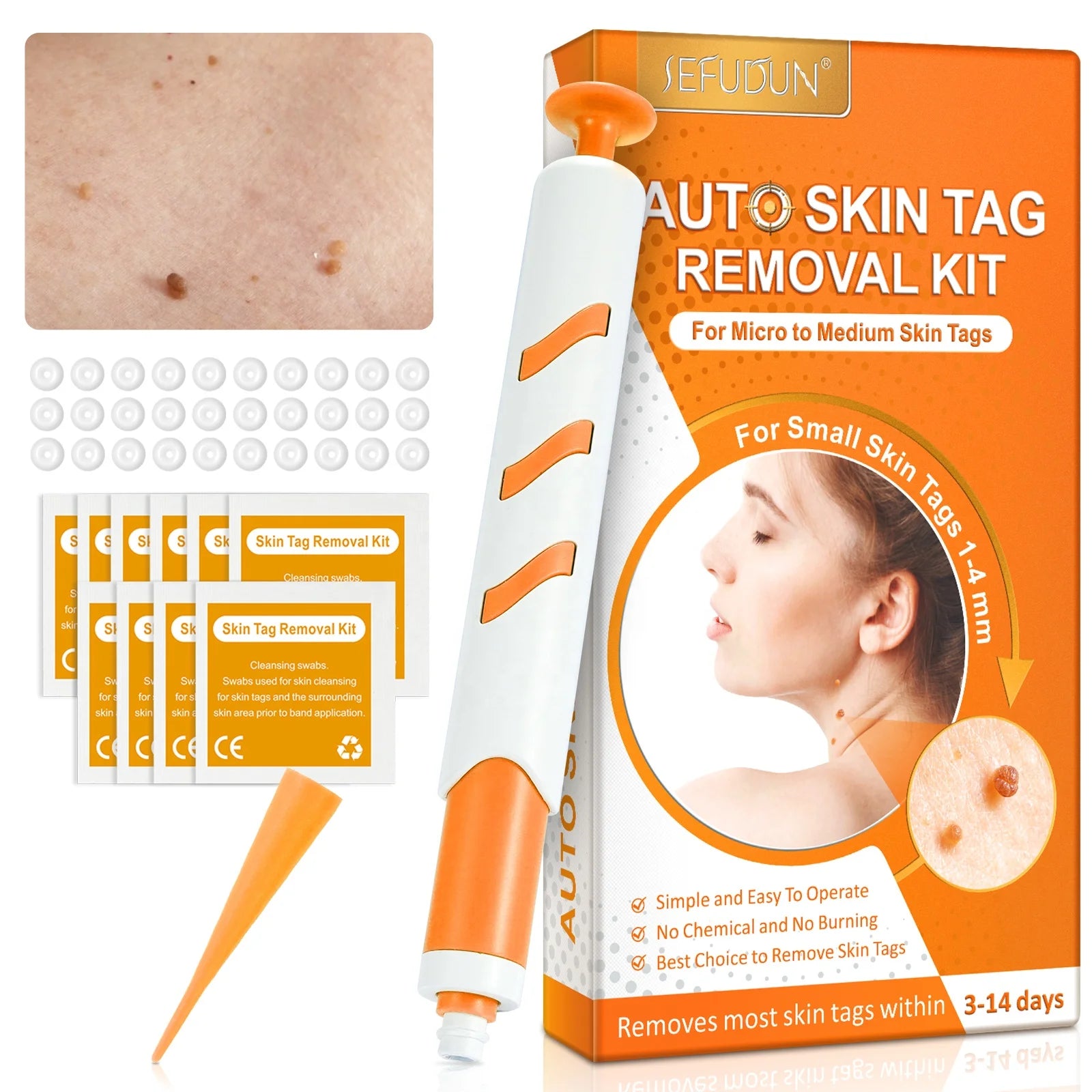 SEFUDUN Safe Auto Standard Smooth Micro Medium Rubber Bands Tools Warts Remover Patches Skin Tag Removal Kit