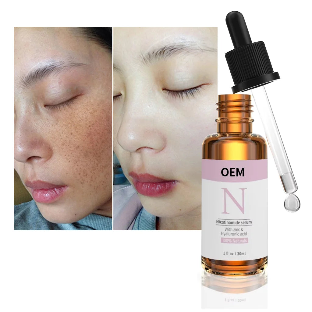Professional OEM Vegan Niacinamide Face Serum Anti Aging Arbutin Hyaluronic Acid Balance Care Advanced Niacinamide Face Serum