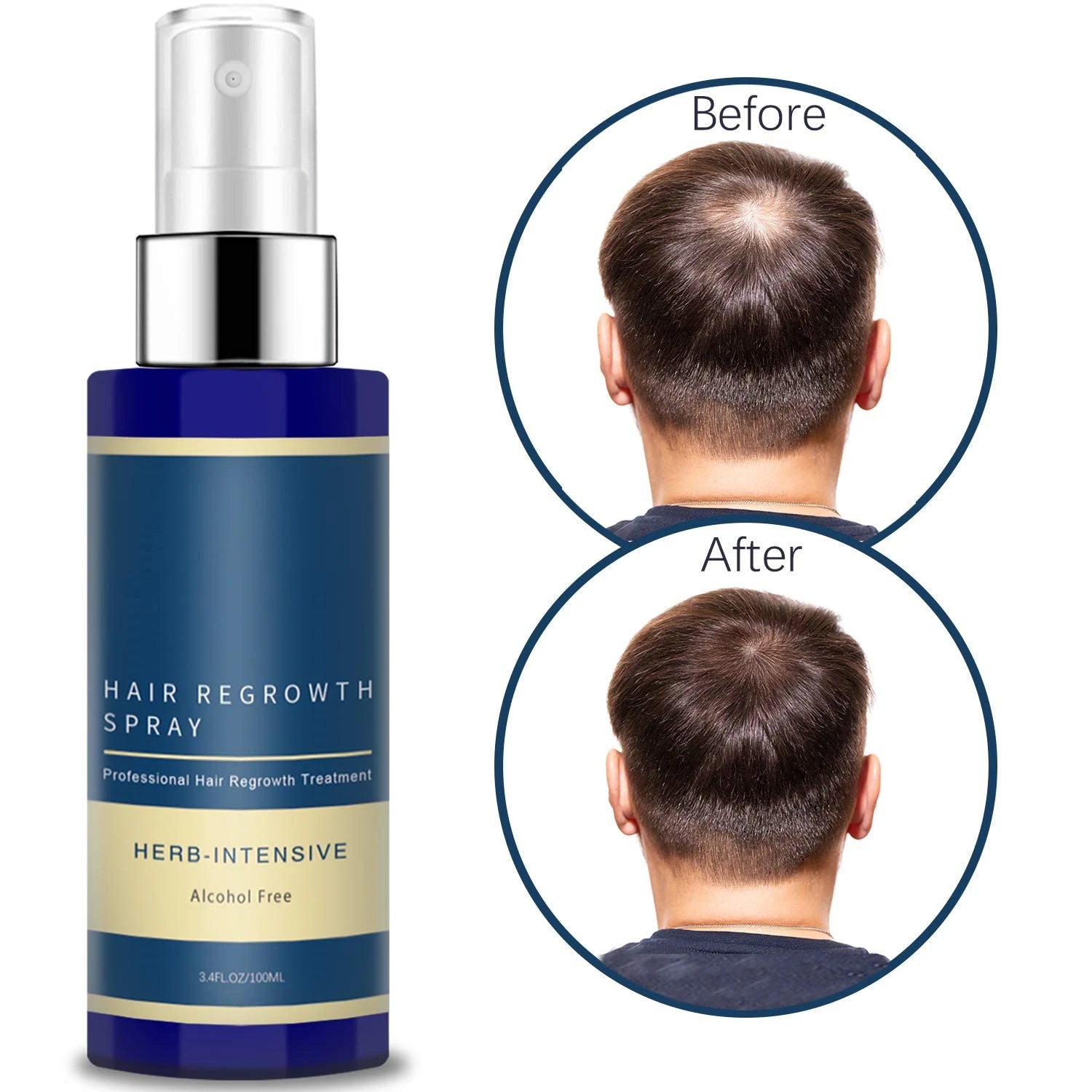 Private Label Organic Fast Effective Hair Fall Loss Treatment Biotin Hair Growth Spray