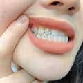 18K Gold Multifunction Teeth Whitening Gel Tooth Other Tooth Gems Accessories Led Kit Price