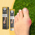 OEM South Moon 20g Bee Venom Care Cream Joint Bunion Pain Reducing Joint Mobility Increasing Swelling Relieving Toe Care Cream