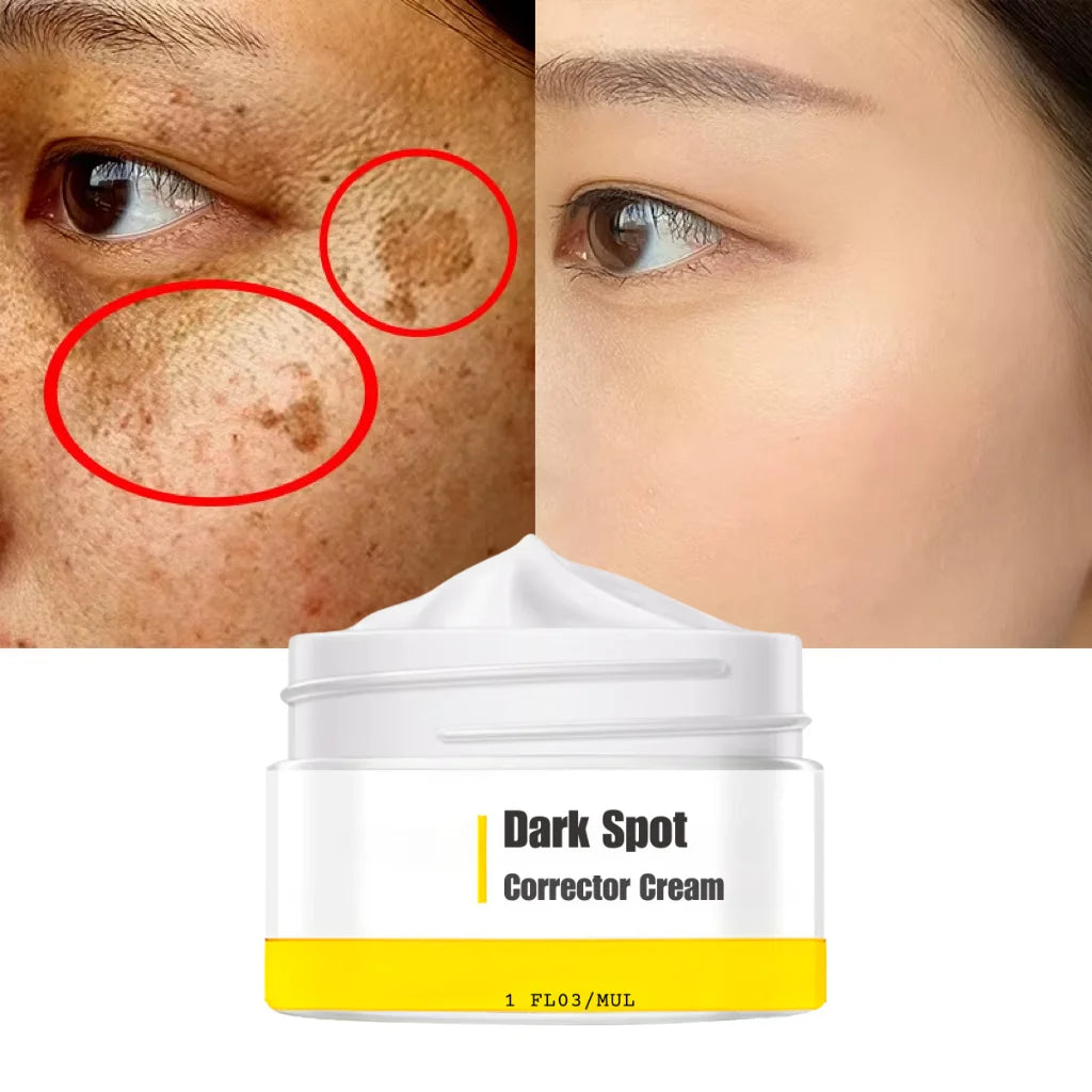 Private Label Freckle Removal Whitening Dark Spot Remover Face Cream with Vitamin E Pearl & Emu Oil