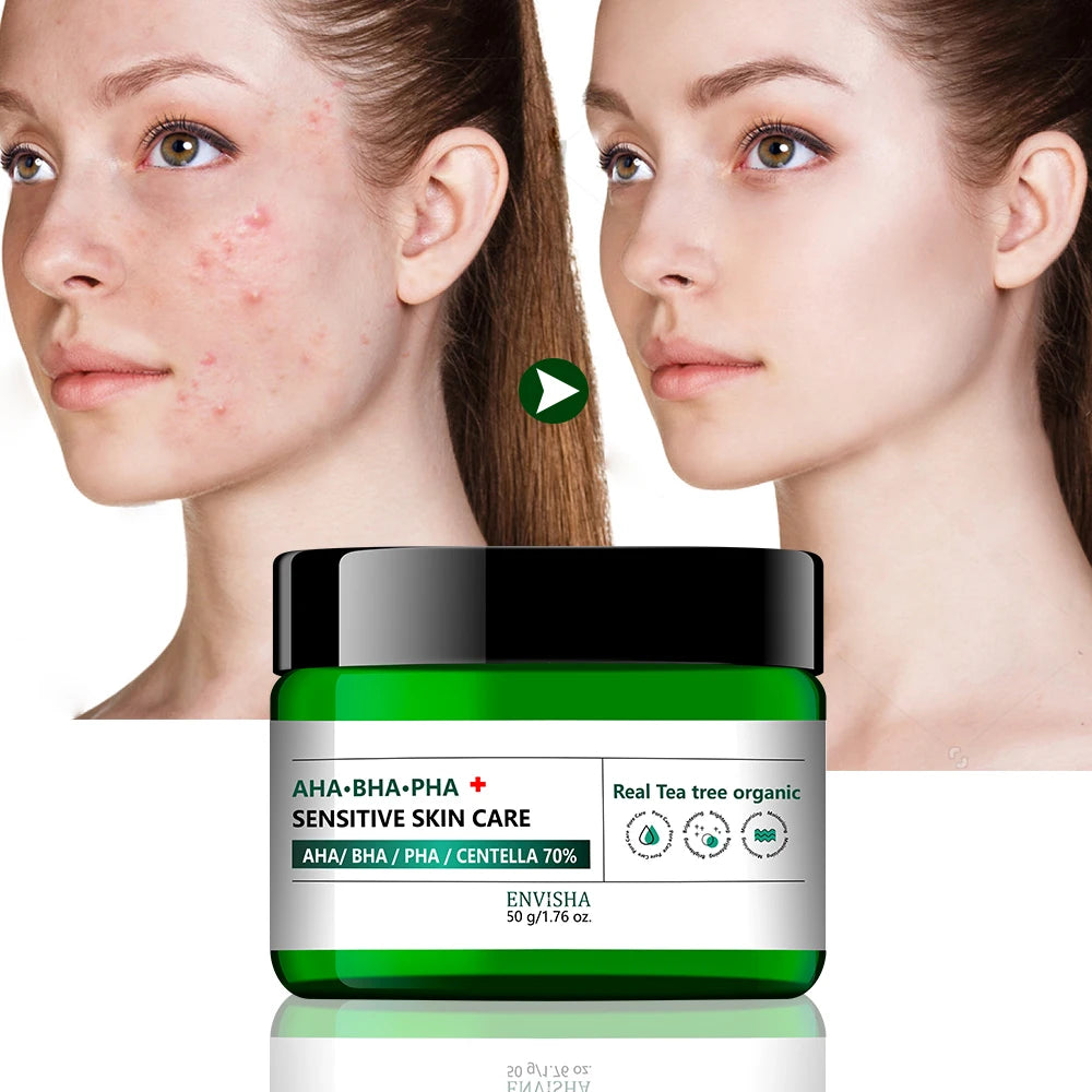 Private Label Vegan AHA BHA PHA Tea Tree Leaf Water Daily Facial Acne Skin Exfoliating Moisturizing Cream