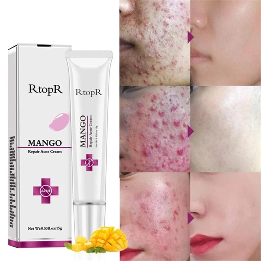 Hot Sale Organic Herbal Face Cream for Acne & Scar Removal Top-Rated Collagen Gel for Effective Skin Care