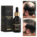 Private Label Natural Organic Herbal Ginger Biotin Anti Hair Loss Boosting Fast Hair Growth Hair Oil Hair-Repairing
