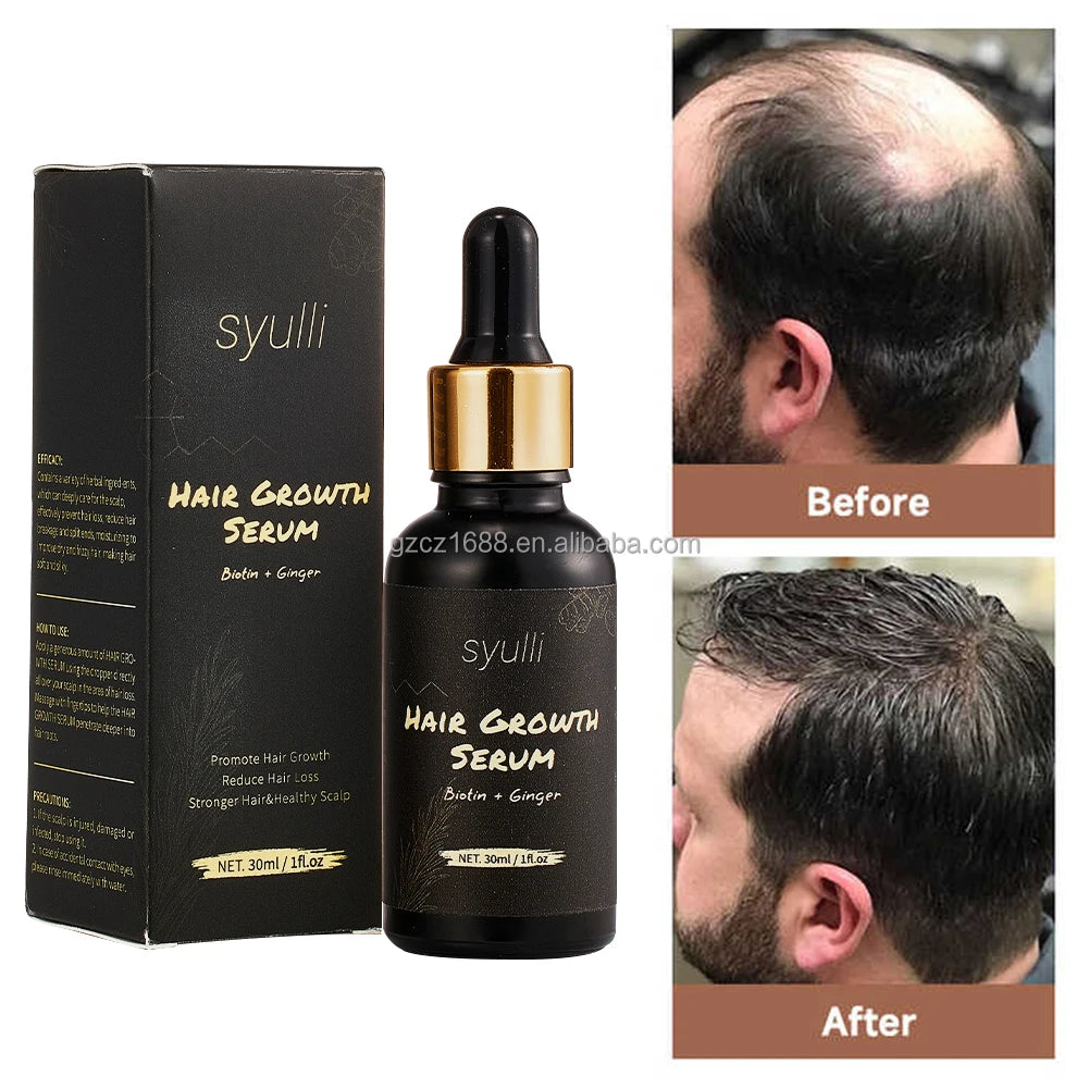 Private Label Natural Organic Herbal Ginger Biotin Anti Hair Loss Boosting Fast Hair Growth Hair Oil Hair-Repairing