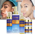 Retionl-Collagen Day Night Vitamin C Face Cream Snail Extract Moisturizer Anti-Aging Sensitive Skin Whitening Skin Care Set MegaBDM