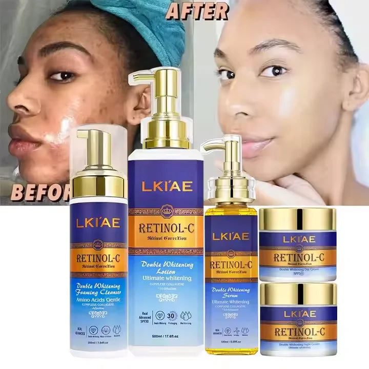Retionl-Collagen Day Night Vitamin C Face Cream Snail Extract Moisturizer Anti-Aging Sensitive Skin Whitening Skin Care Set MegaBDM