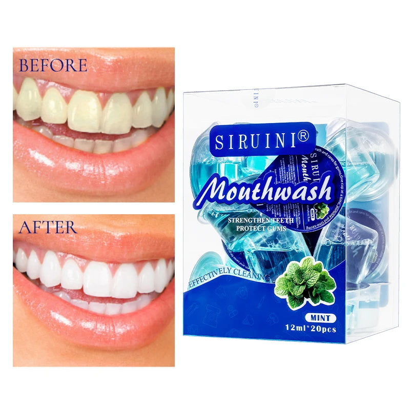 Dental Care Kit Tooth Vitamin E Teeth Whitening Kit Products Oral Care Hotel Amenities Dental Whitener Mouth Wash Mouthwash
