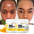 Ailke Skin Care Manufacturers Beauty Evens Tone Anti Acne Antiaging Vitamin C Turmeric Face Cream Lotion for Women