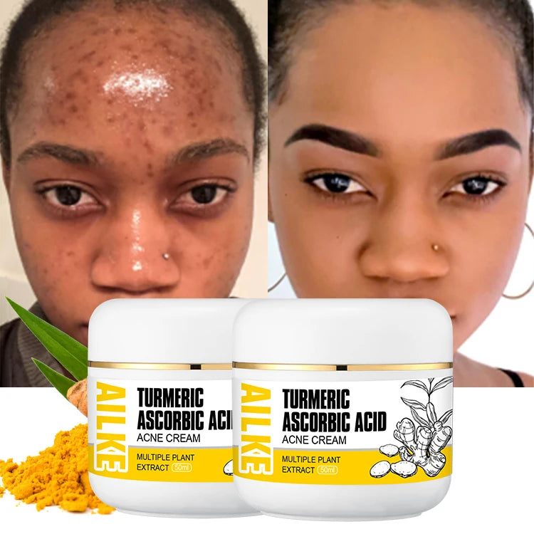 Ailke Skin Care Manufacturers Beauty Evens Tone Anti Acne Antiaging Vitamin C Turmeric Face Cream Lotion for Women