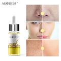 Hot Selling Vitamin c Serum Private Label Organic Whitening Acne Removing Anti Aging Face Care Serum Custom logo