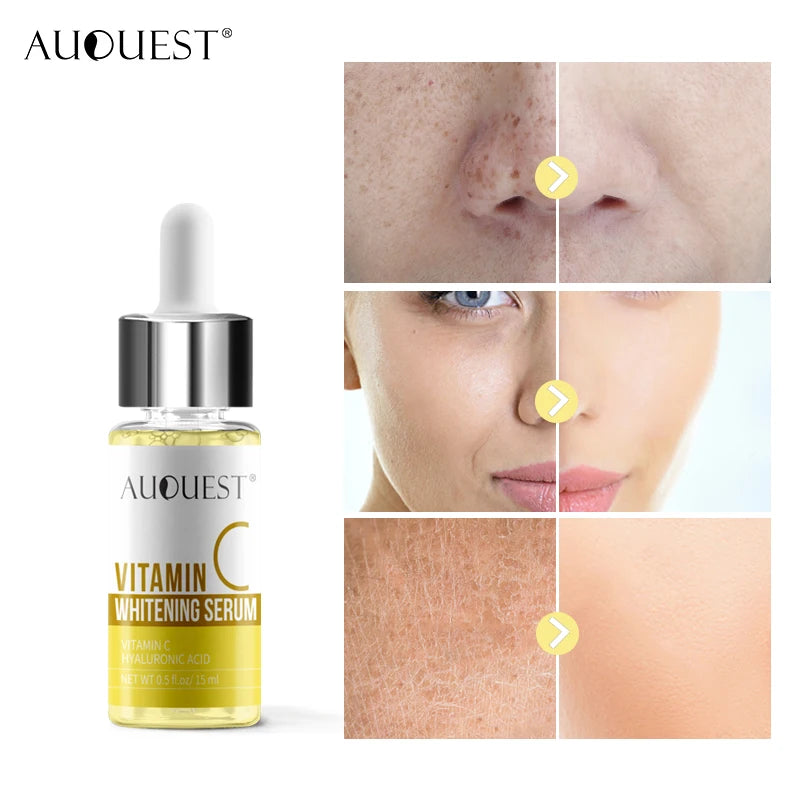 Hot Selling Vitamin c Serum Private Label Organic Whitening Acne Removing Anti Aging Face Care Serum Custom logo