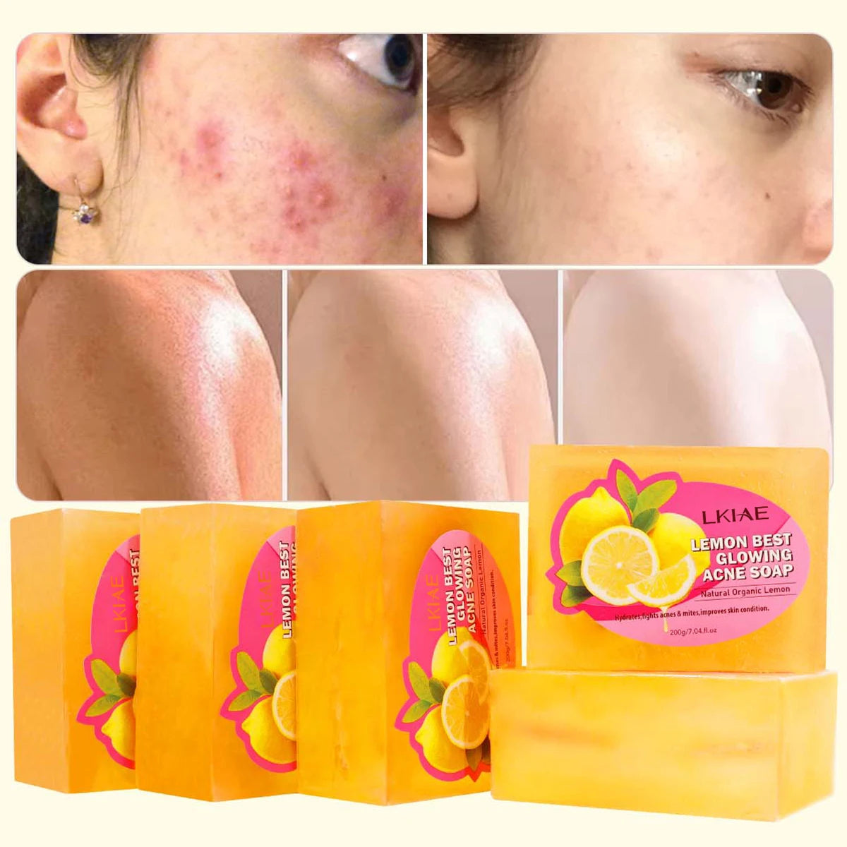 Lemon Moisturizing Acne Shrinking Pores Whitening Solid Bar Soap Handmade with Mite Sterilization OEM Private Label
