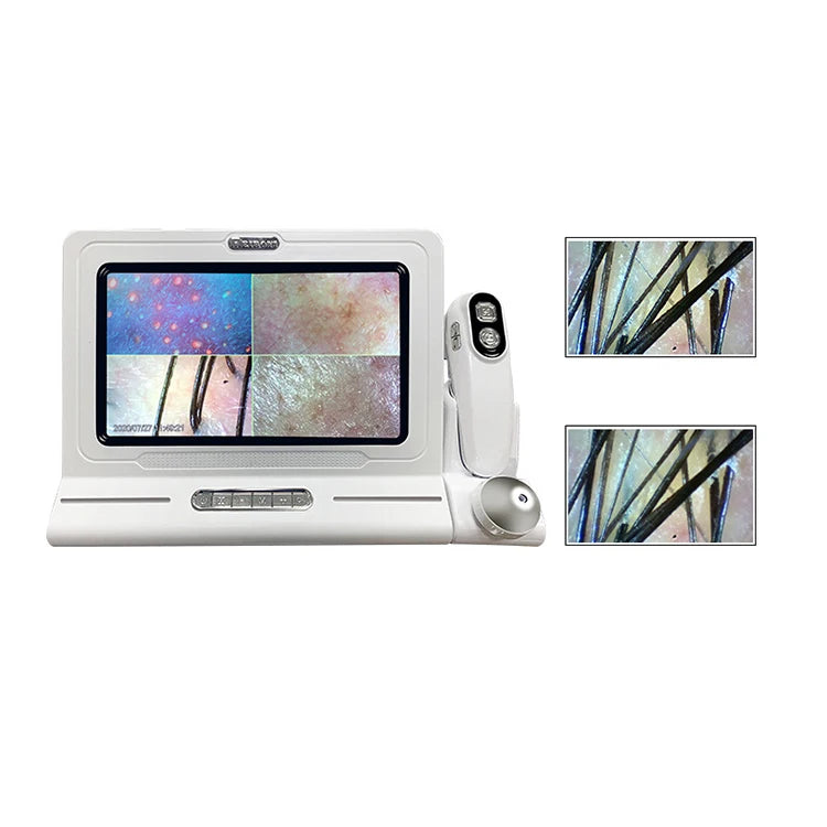 Mini Multifunction Skin Analyzer Hair Follicle Scalp Detector Portable Skin and Hair Analyzer Machine Hair Analyzer Scalp Beauty