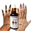 Hight Quality Private Label  50ml Knuckle Whitening Serum Hand Elbow and Knee Knuckle Glow Removing Dark Black Spot White Serum