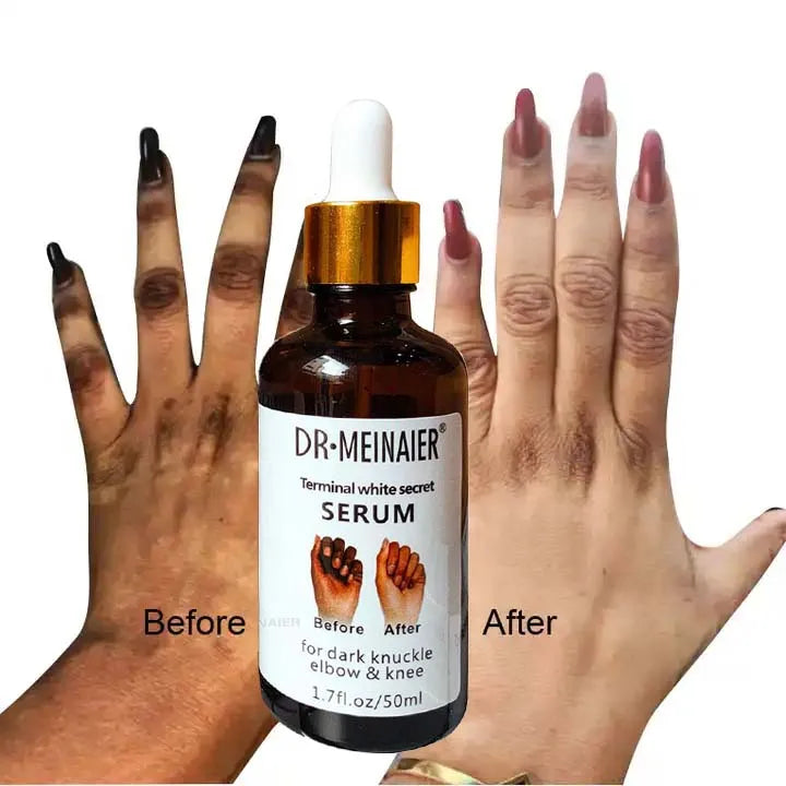 Hight Quality Private Label  50ml Knuckle Whitening Serum Hand Elbow and Knee Knuckle Glow Removing Dark Black Spot White Serum