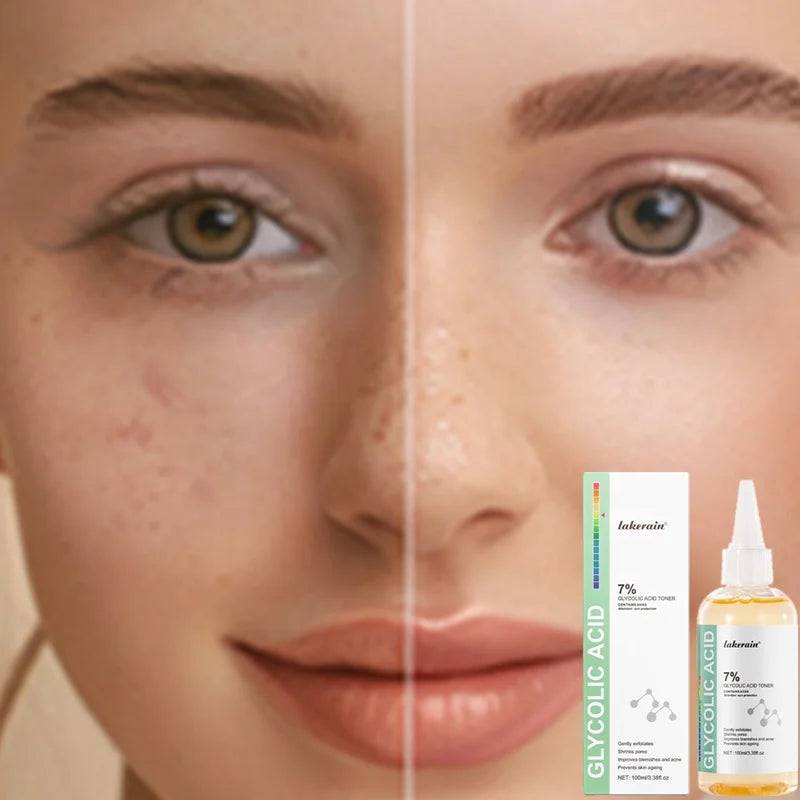 Lakerain 100ml Glycolic Acid Toner Moisturizing Brightening Exfoliating Acne Reducing Pores Shrinking Anti Aging Skin Toner