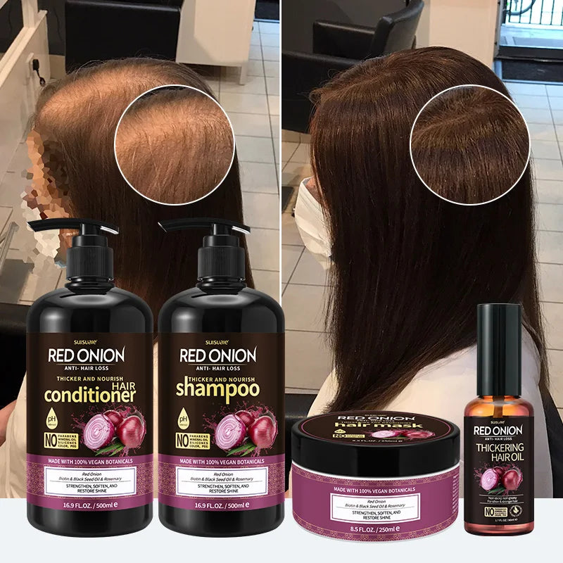 100% Pure Natural Private Label Organic Onion Hair Growth Keratin Treatment Shampoo and Conditioner Set