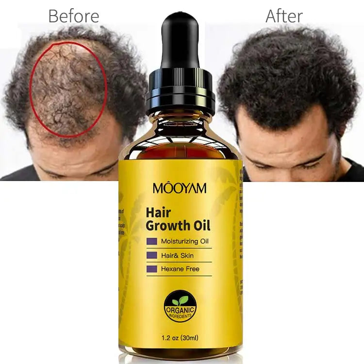 OEM Custom Logo Fast Hair Growth Oil Private Label Anti Hair Loss Organic Hair Growth Oil for Women