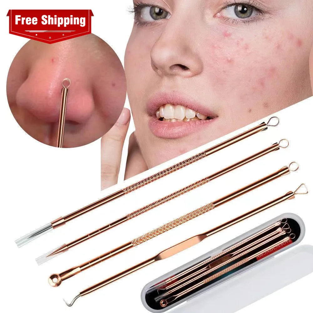 Free Shipping Acne Blackhead Removal Squeeze Deep Cleansing Facial Skin Care Tools