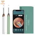Pakiss Ear Cleaning Endoscope Ear Pick Tools Electric Ear Wax Remover Cleaning Spoon