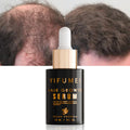 Hot Selling Herbs Blend Argan Rosemary Oil Mega Hair Growth Elixir Natural Organic Treatment Hair Growth