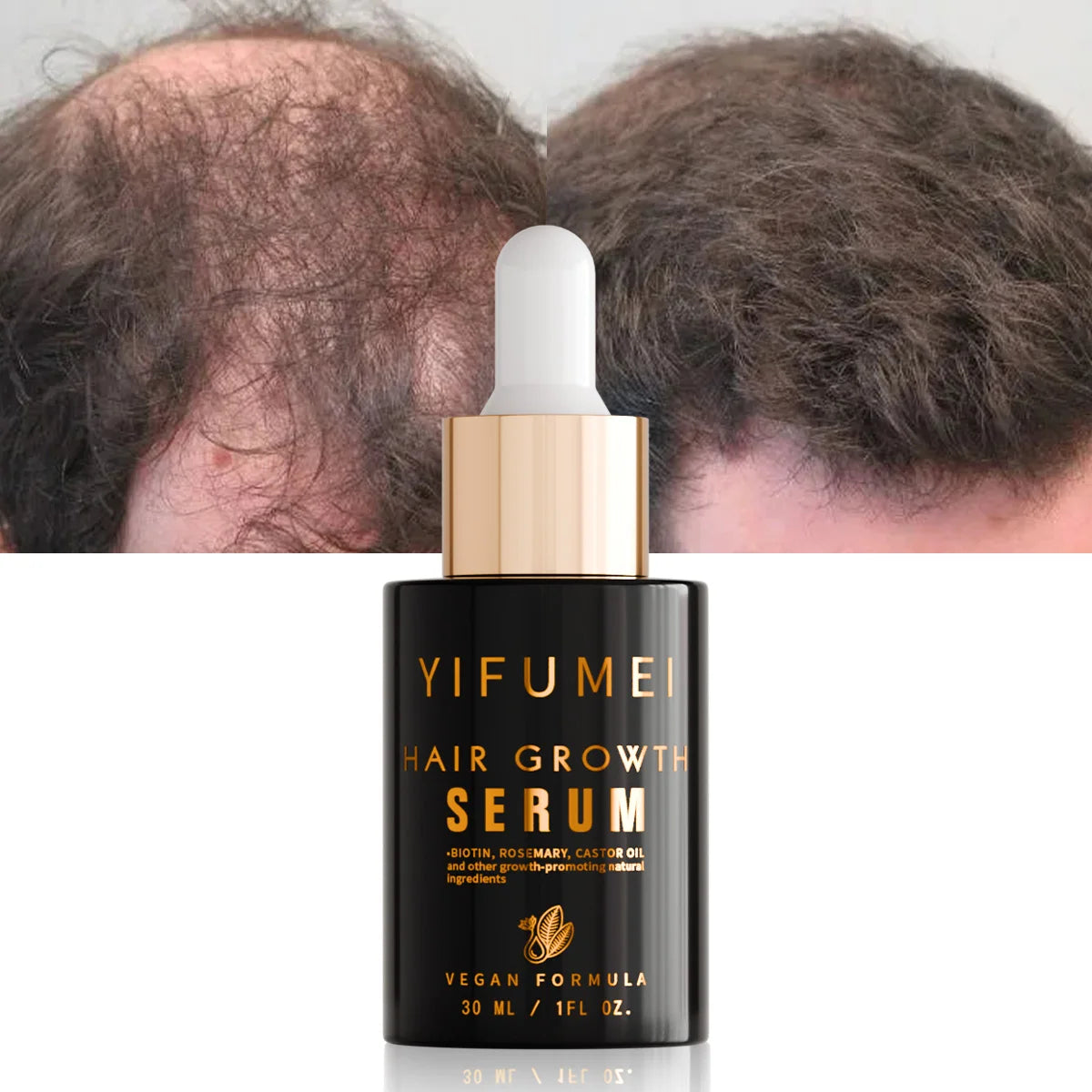 Hot Selling Herbs Blend Argan Rosemary Oil Mega Hair Growth Elixir Natural Organic Treatment Hair Growth