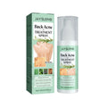 Anti Acne Spray Skin Care Body Spray Whitening Fine Mist Spray Body  Mask Acne Trending Item Hydrating
