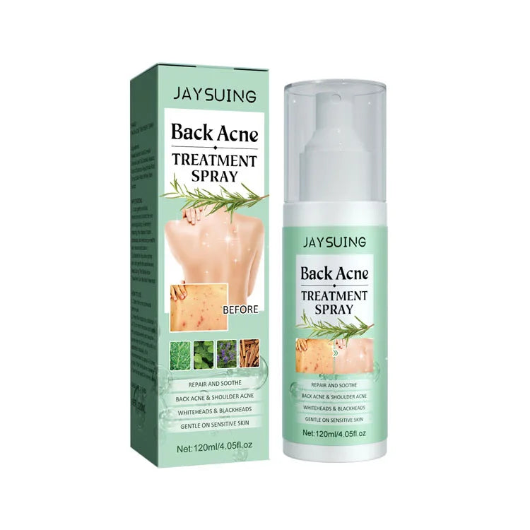 Anti Acne Spray Skin Care Body Spray Whitening Fine Mist Spray Body  Mask Acne Trending Item Hydrating