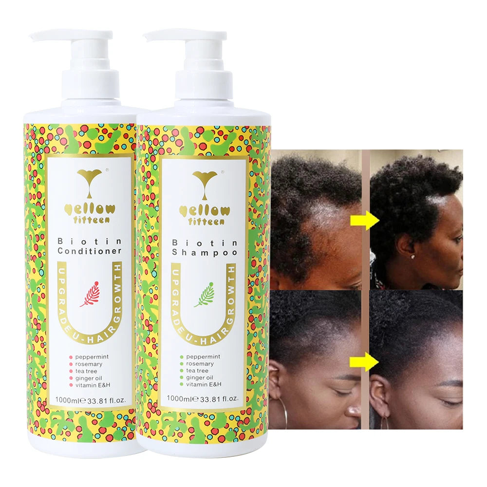 Private Label Mint Hair Growth Thickening Shampoo Oil Natural Biotin Anti Loss Hair Grow Conditioner