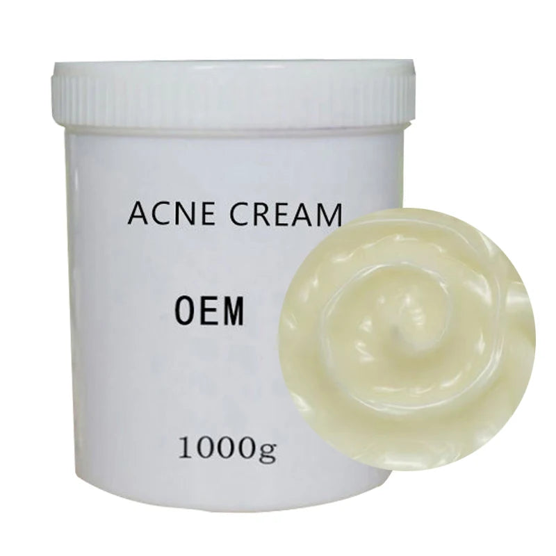 Hot Selling Acne Face Cream Organic Deep Acne Skin Repair Whitening Face Acne Dace Cream 1kg