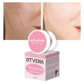 OTVENA Dark Spot Remover Whitening Face Cream Skin Whitening Cream Without Side Effects