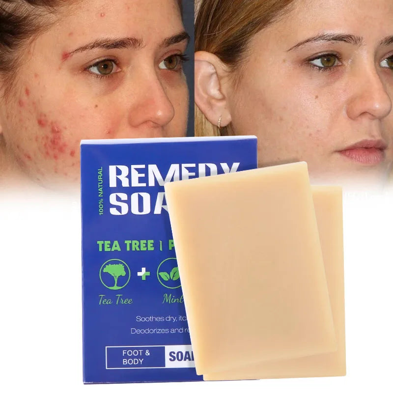 Private Label Natural Organic Body Wash for Healing Refreshing Cleansing Tea Tree Peppermint Nourishing Remedy Soap