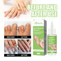 Wholesale Nail Repair Serum Feet Care Strength Liquid for Damaged Nails
