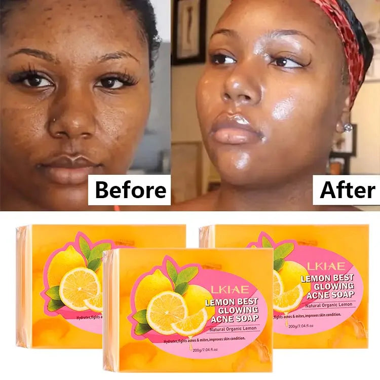 Wholesale Bath Women Skincare Moisturizing Body Cleansing Brightening Handmade Acne Lemon Whitening Soap
