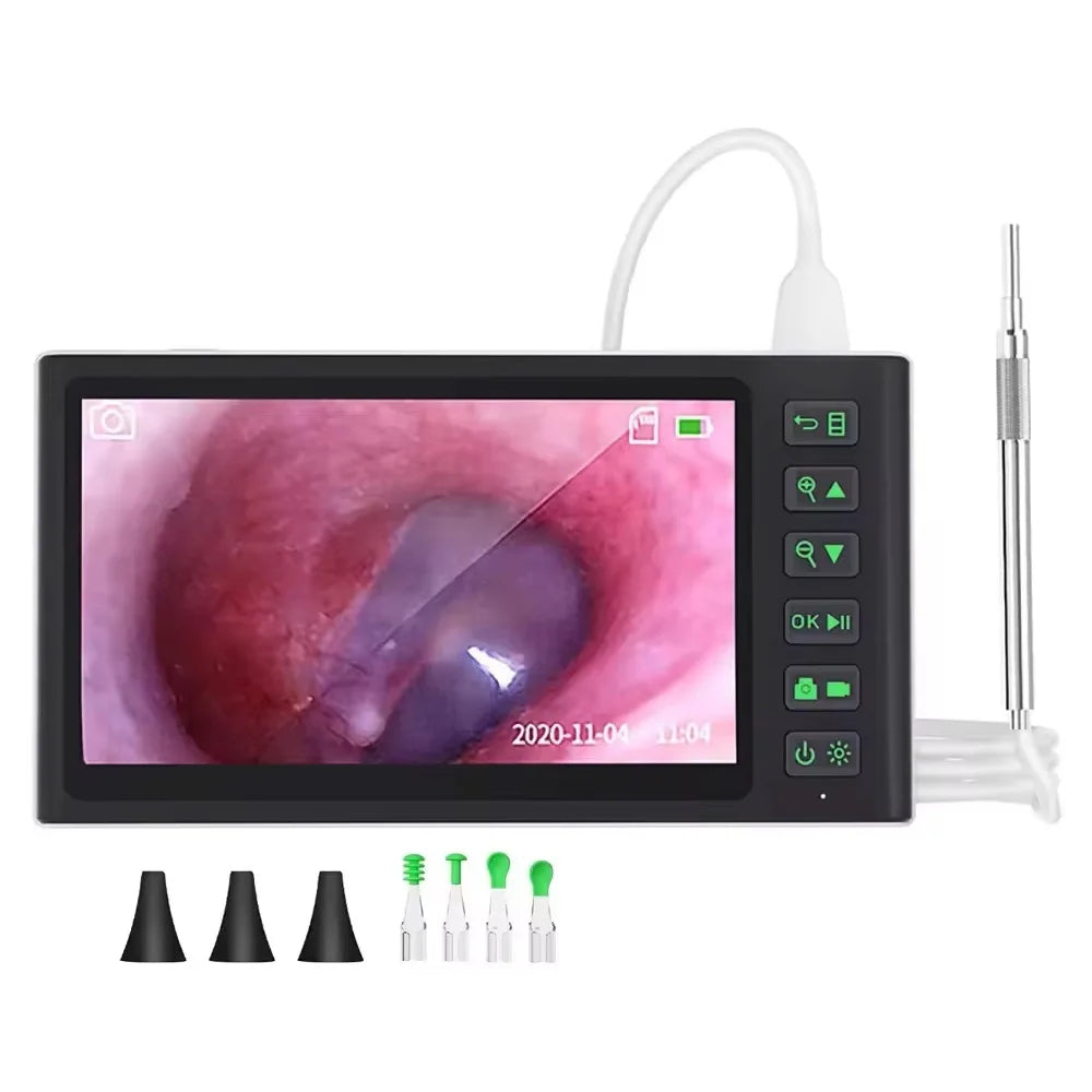 7inch Screen Visual Ear Cleaner Smart Digital Camera Remover Endoscope Ear Wax Picker Professional IPS Screen Ear Wax Removal