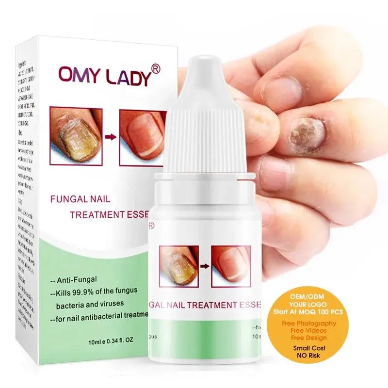 Professional Fungal Nail Gel for Finger and Feet Nail Care Effective Nail Fungus Treatment