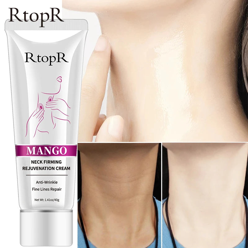 Rtopr 40g Mango Neck Cream Darkness Removal Lifting and Firming Rejuvenation Main Ingredient Glycerin