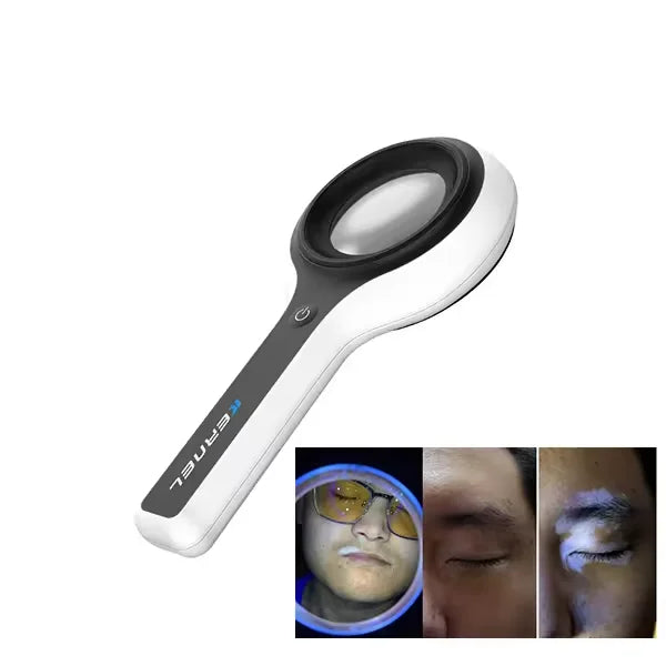 Portable Handheld Lamp Medical Uv Light Facial Skin Analysis Skin Scope Analyzer Mini Wood Lamp Skin Analyzer UV Light Wood Lamp