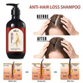 Wholesale Smooth Moisturizing Bulk Normal Hair 300 ml Ginseng Anti Hair Loss Shampoo