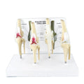 4 Stages Dog Knee Model Life Size PVC Dog Artificial Knee Joint Model
