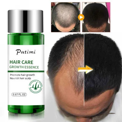 Wholesale Organic Tea Tree Oil Hair Growth Serum Fast Hair Nutrition Scalp Care 3 Years OEM ODM Private Label Hair Treatment
