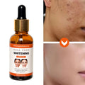 Private Label Natural Arbutin Face Care Serum Organic Vegan Anti Aging Skin Essential Oil Essences Visage Facial Whitening Serum