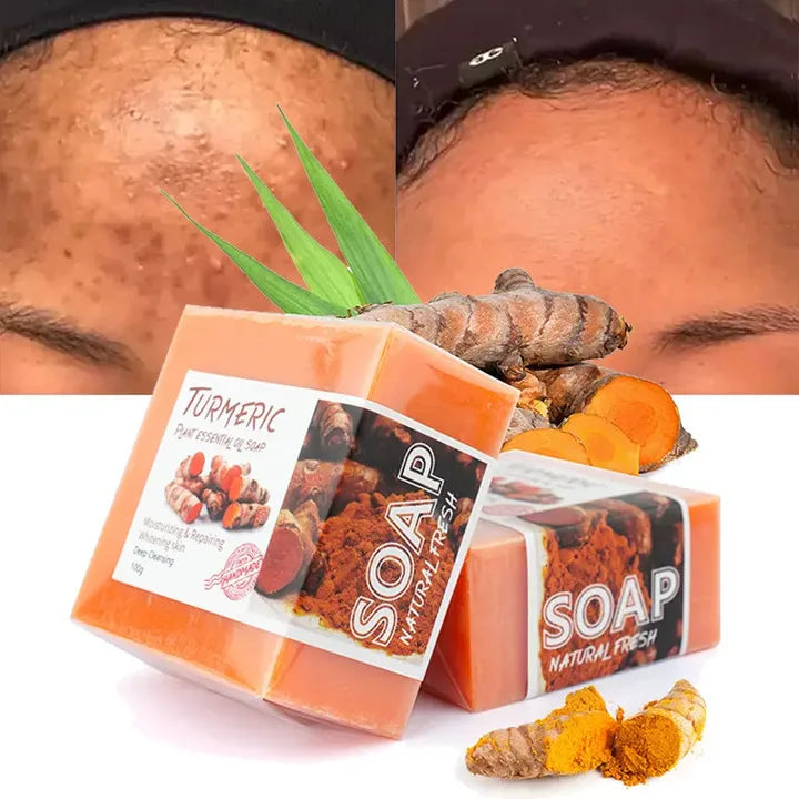 Handmade Kojic Acid Soap for Oily Turmeric Papaya Orange Essential Oils Solid Bar Soap Brightens Made Shea Butter for Adults