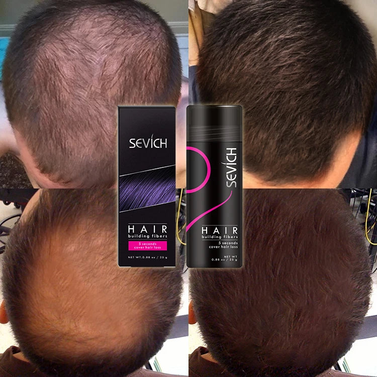 Manufacturer Professional Keratin Hair Fiber Powder Spray Applicator for Bald People Hair Loss Cover