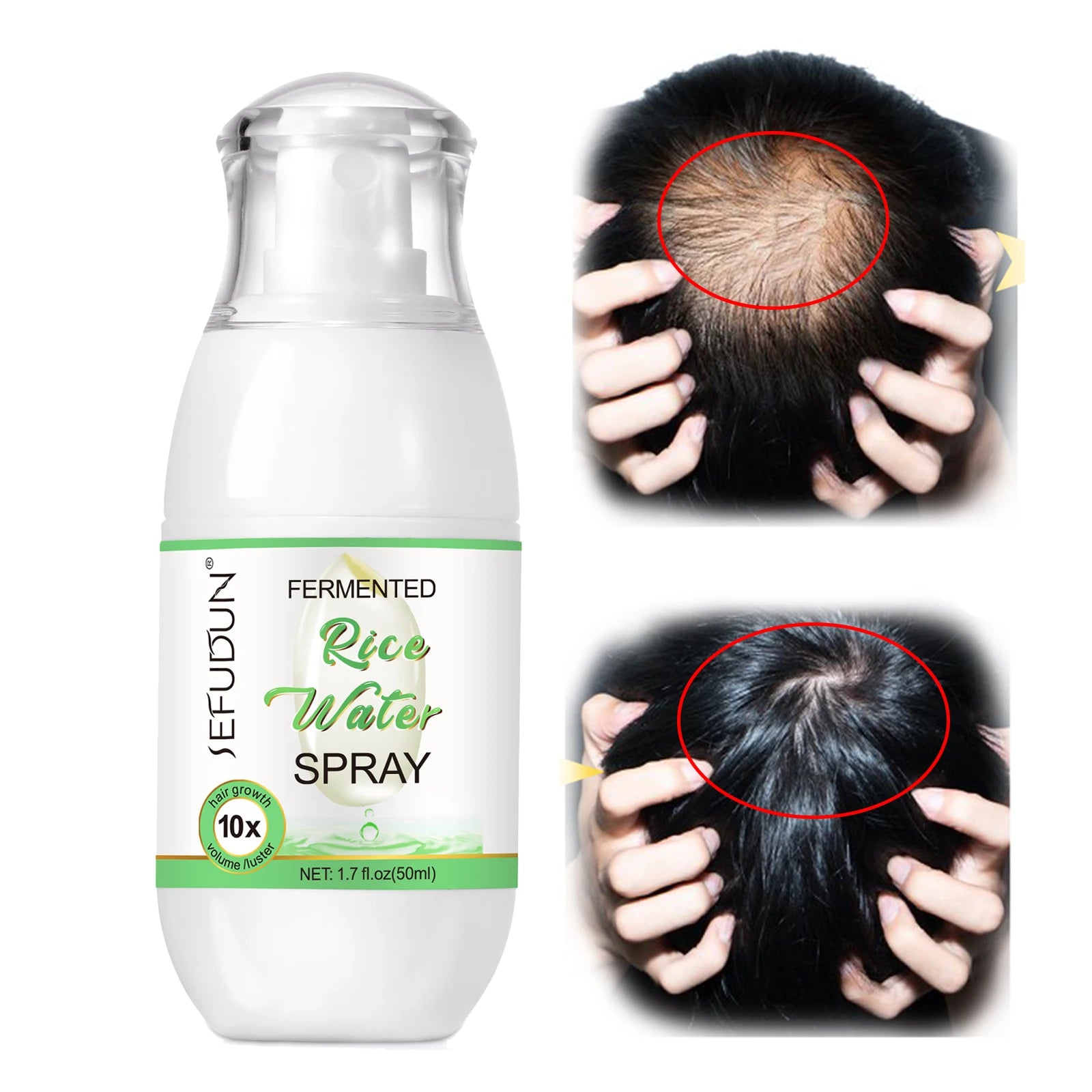 SEFUDUN Hot Sale 50ml White Rice Water Hair Growth Spray for Women Men Hair Loss Hydrating Repair