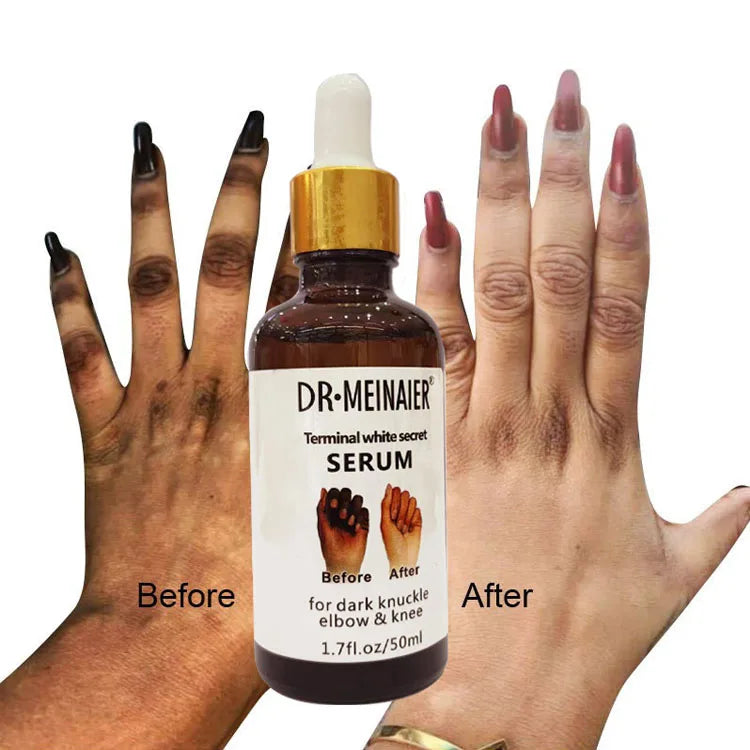 Wholesale Whitening Brightening Removing Blacking for Dark Knuckle Elbow&knee Hand Brighten Moisture Serum
