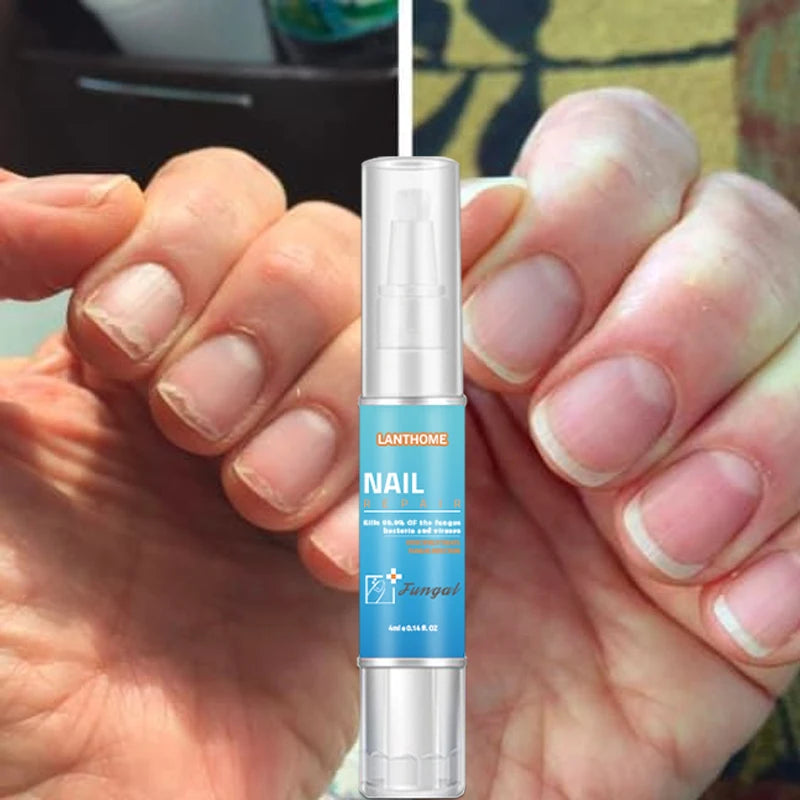 Lanthome Wholesale 4ml Herbal Nail Repair Tools Anti Fungal Toenail Nail Fungus Treatment Pen for Care