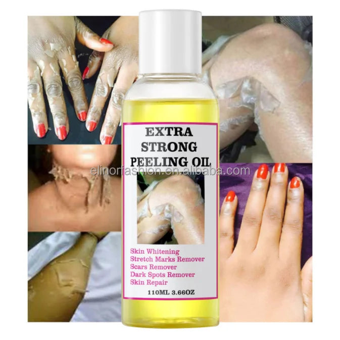 Private Label Yellow Peeling Oil Aloe Vera Shea Butter Extra Strength Exfoliating Whitening Bleaching for Body Remove Dead Skin